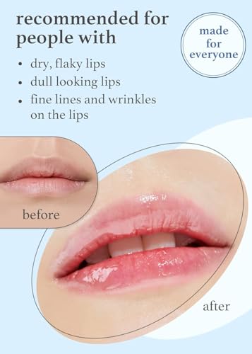 NOONI Korean Vegan Lip Oil - Appleginseng | Lip Stain, Gift, Long-Lasting, Moisturizing, Plumping, Revitalizing for Dry Lips, Waterproof, No Peel Off, Korean Lip Tint 0.12 Fl Oz